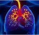 Asthma drug may help fight dangerous food allergy in kids: Study