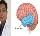 Mumbai woman cured of epilepsy after part of her brain removed