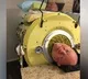 Polio patient Paul Alexander with iron lungs passes away at the age of 78