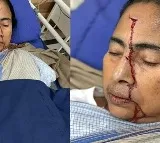 Mamata Banerjee fell probably because of a push from behind says SSKM Director