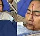 Mamata Banerjee fell probably because of a push from behind says SSKM Director