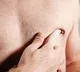 Key Facts About Male Breast Cancer Do You Know This