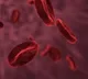 New advanced treatments offer hope for multiple myeloma patients
