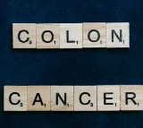 Why are young people more prone to colon cancer in India?