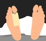 Bengaluru Man Dies After Friend Pumps Hot Air Into His Rectum For Fun