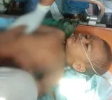 After 17 hours long efforts, toddler Satwik Mujagonda rescued from borewell