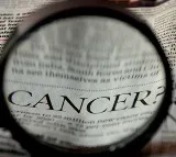Prostate cancer cases to double, deaths to rise by 85 pc by 2040: Lancet