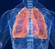 Study links colourless, odourless gas with the rise in lung cancers in non-smokers