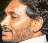 YSR Congress blames TDP for attack on Jagan