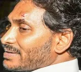 YSR Congress blames TDP for attack on Jagan