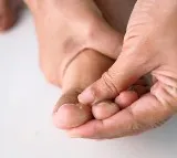 New shoe insole technology to reduce diabetic foot ulcer risk