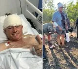 Former Zimbabwe cricketer survives leopard attack