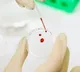 blood test powered by ai could catch osteoarthritis 8 years earlier
