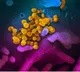 Undiagnosed immune deficiency rising among Indian children: Doctors