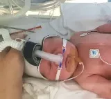 Study shows how to boost lung health of premature babies