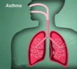 'IDIOT' syndrome hampers asthma treatment: experts