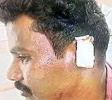 YSRCP leader cuts ear of TDP follower