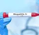 Alert Issued in Kerala After Hepatitis A Outbreak