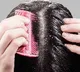 Why Dandruff Attacks