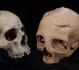 Cut marks on 4,000-yr-old skulls show ancient Egyptians tried to treat cancer