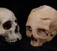 Cut marks on 4,000-yr-old skulls show ancient Egyptians tried to treat cancer