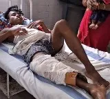 Bihar man goes to hospital with fractured bone they put cardboard cast on his leg