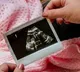 Govt amends surrogacy rules, govt employees to get 6-month break