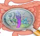 Blame a gut bacteria for your compulsive eating, obesity
