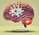 Know all about brain-eating amoeba infection that claimed two lives in Kerala