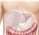 Limit ghee, coconut oil if you have fatty liver disease: Expert