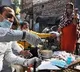 Here’s how Zika virus can impact pregnancy, cause newborn complications