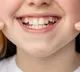 Here are some important tips to keep your teeth sparkling