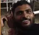 Snake bites man in Bihar he bites it back twice Reptile dies man survives