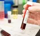 47 students died of HIV infection and 828 tested positive in Tripura