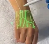 Anand Mahindra shares video of new tech detecting veins using infrared light