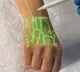 Anand Mahindra shares video of new tech detecting veins using infrared light