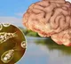 Nilofar doctors warns that be caution with brain eating amoeba
