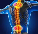 Study shows spinal muscular atrophy may raise risk of liver damage