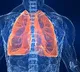 Why are most lung cancer patients in India non-smokers?