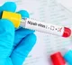 Centre alerts state govts after Nipah virus emerged in Kerala