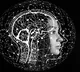Healthy lifestyle, awareness key to combat rising brain stroke,
 diseases: Experts