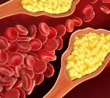 Indian researchers find a new, cheaper route to manage cholesterol
