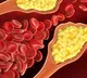 Indian researchers find a new, cheaper route to manage cholesterol