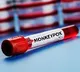 Australian health authorities issue warning over rising mpox infections