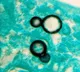Pune scientists’ new drug delivery method to combat fungal infections