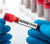 Can Mpox virus spread through air like Covid-19?