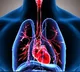 lung cancer vaccine tested on uk patient
