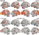 Scientists reveals how love lights up different parts of human brain