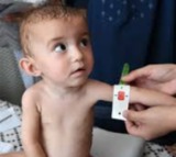 Afghanistan: 26 children die of malnutrition in Badakhshan