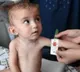 Afghanistan: 26 children die of malnutrition in Badakhshan